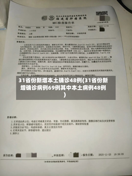 31省份新增本土确诊48例(31省份新增确诊病例69例其中本土病例48例)-第3张图片